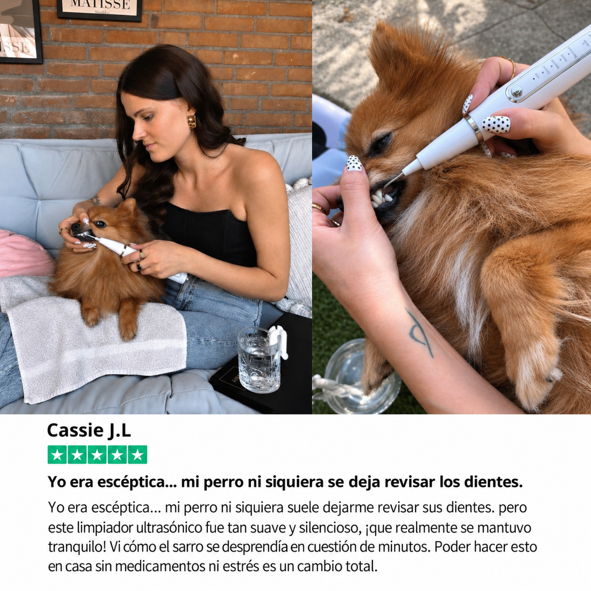 Kit Goldoris - Eliminador Ultrasónico Silencioso De Placa Y Sarro Para Perros