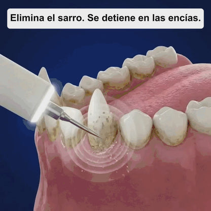 Kit Goldoris - Eliminador Ultrasónico Silencioso De Placa Y Sarro Para Perros